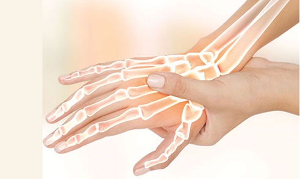 Carpal tunnel syndrome