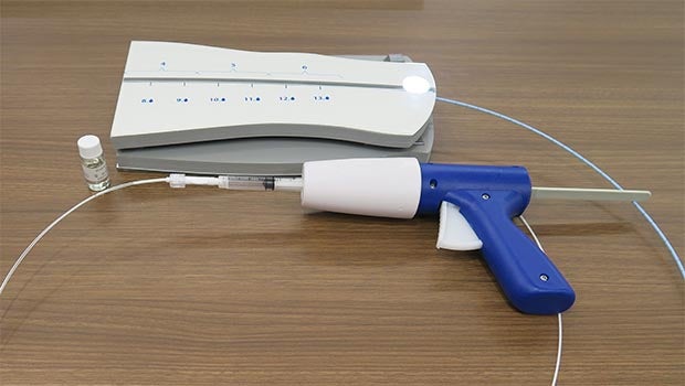 Gluing varicose veins shut