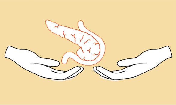 Pancreas transplant programme at Singapore General Hospital