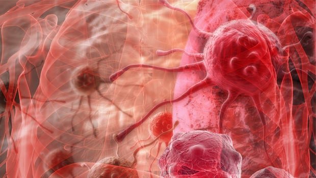 ​In-depth study of lung cancer mutations