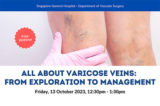 All About Varicose Veins: From Exploration to Management