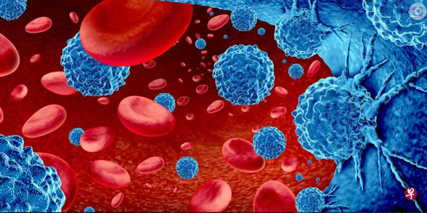 CAR-T细胞疗法是免疫疗法的一种形式，将经过改造的患者细胞被送回患 者体内来对抗癌细胞。（iStock图片） 