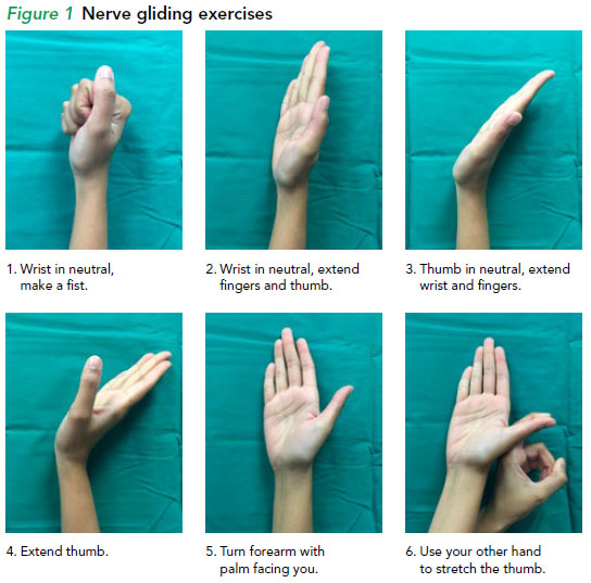 Carpal tunnel syndrome - nerve gliding exercises - SGH