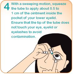 How to apply eye ointment step 4