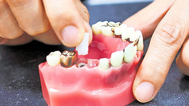  ​​Dental implants will enter a whole new phase if local researchers manage to grow bone in the place where a tooth is missing.