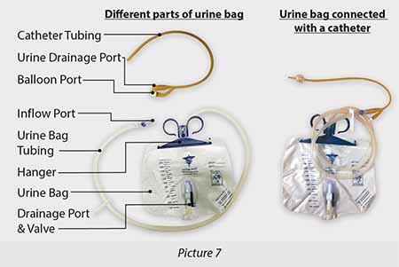 urine bag and holder