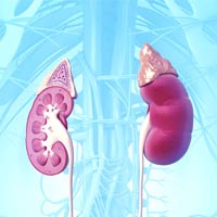 kidney transplant conditions & treatments